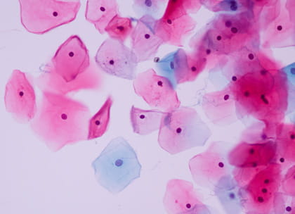 Close-up of cells under microscope